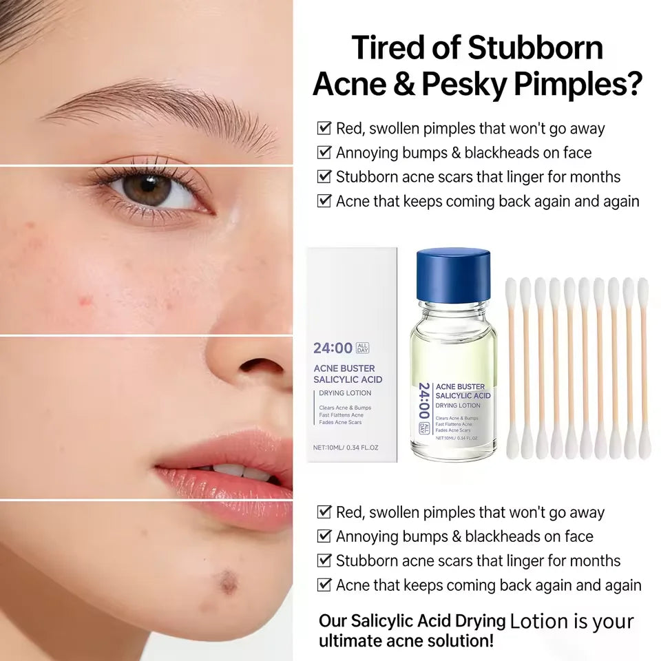 Salicylic Acid Acne Treatment Serum Spot Corrector with Niacinamide Pimple Relief Fades Acne Mark Oil Control for Sensitive Skin
