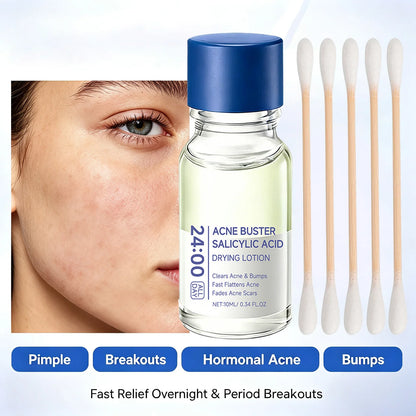 Salicylic Acid Acne Treatment Serum Spot Corrector with Niacinamide Pimple Relief Fades Acne Mark Oil Control for Sensitive Skin